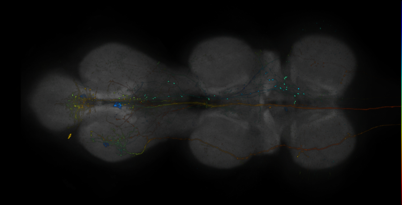 JRC_R14B07-GAL4_MCFO_VNC_20181127_63_A3_40x