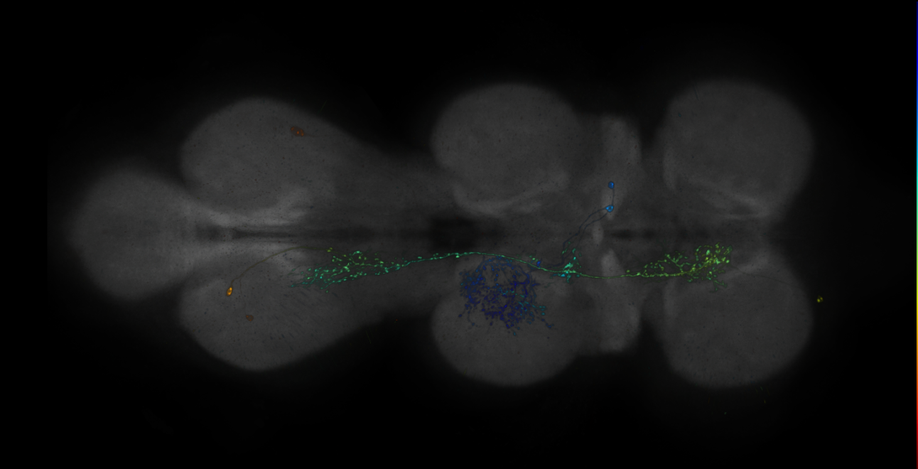 JRC_R17C09-GAL4_MCFO_VNC_20181127_65_E3_40x