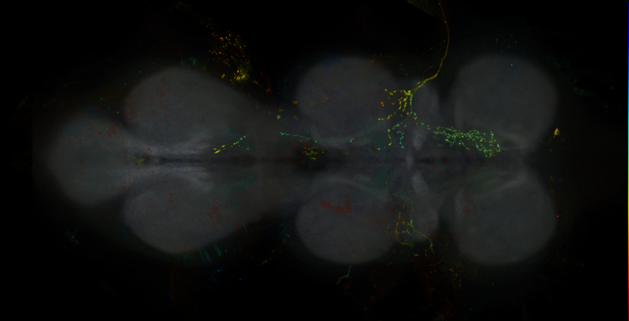 JRC_R17C09-GAL4_MCFO_VNC_20181127_65_E4_40x