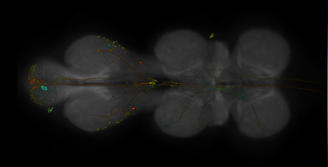 JRC_R17D02-GAL4_MCFO_VNC_20181127_65_I1_40x