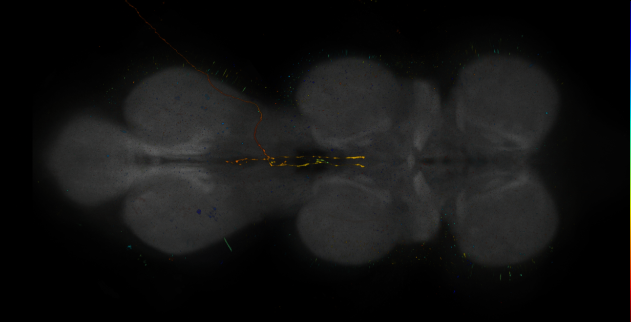 JRC_R17H02-GAL4_MCFO_VNC_20181204_61_F4_40x