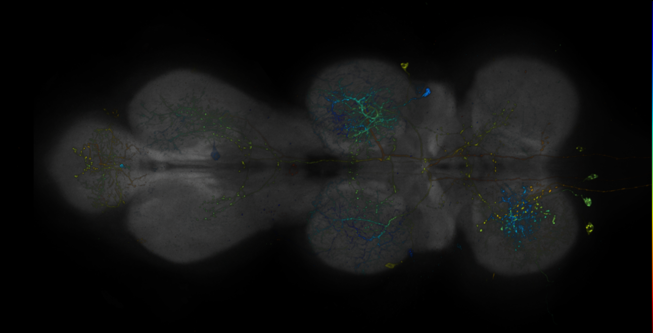 JRC_R18H11-GAL4_MCFO_VNC_20181204_63_E3_40x