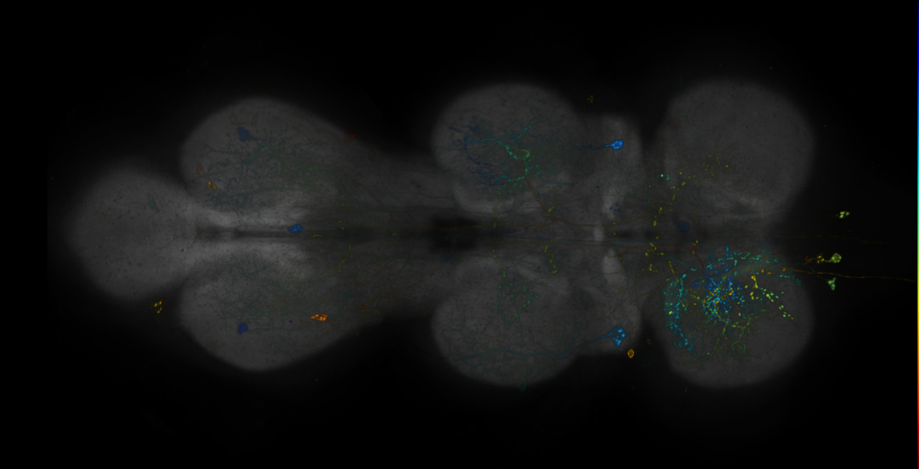 JRC_R18H11-GAL4_MCFO_VNC_20181204_63_E4_40x