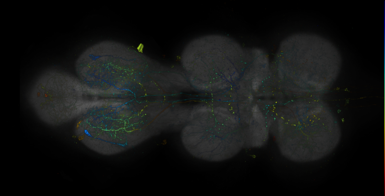 JRC_R18H11-GAL4_MCFO_VNC_20181204_63_E5_40x