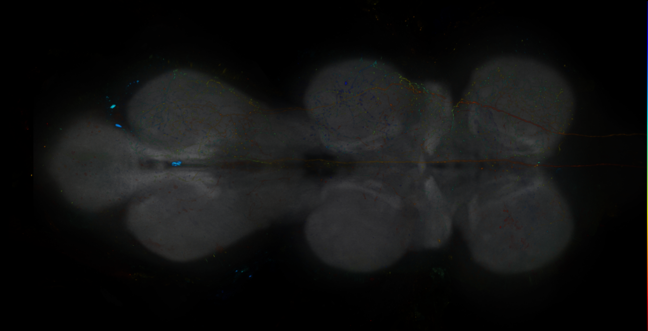 JRC_R19C07-GAL4_MCFO_VNC_20181204_63_J1_40x