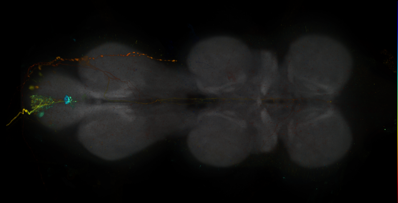 JRC_R11C01-GAL4_MCFO_VNC_20181221_63_C6_40x