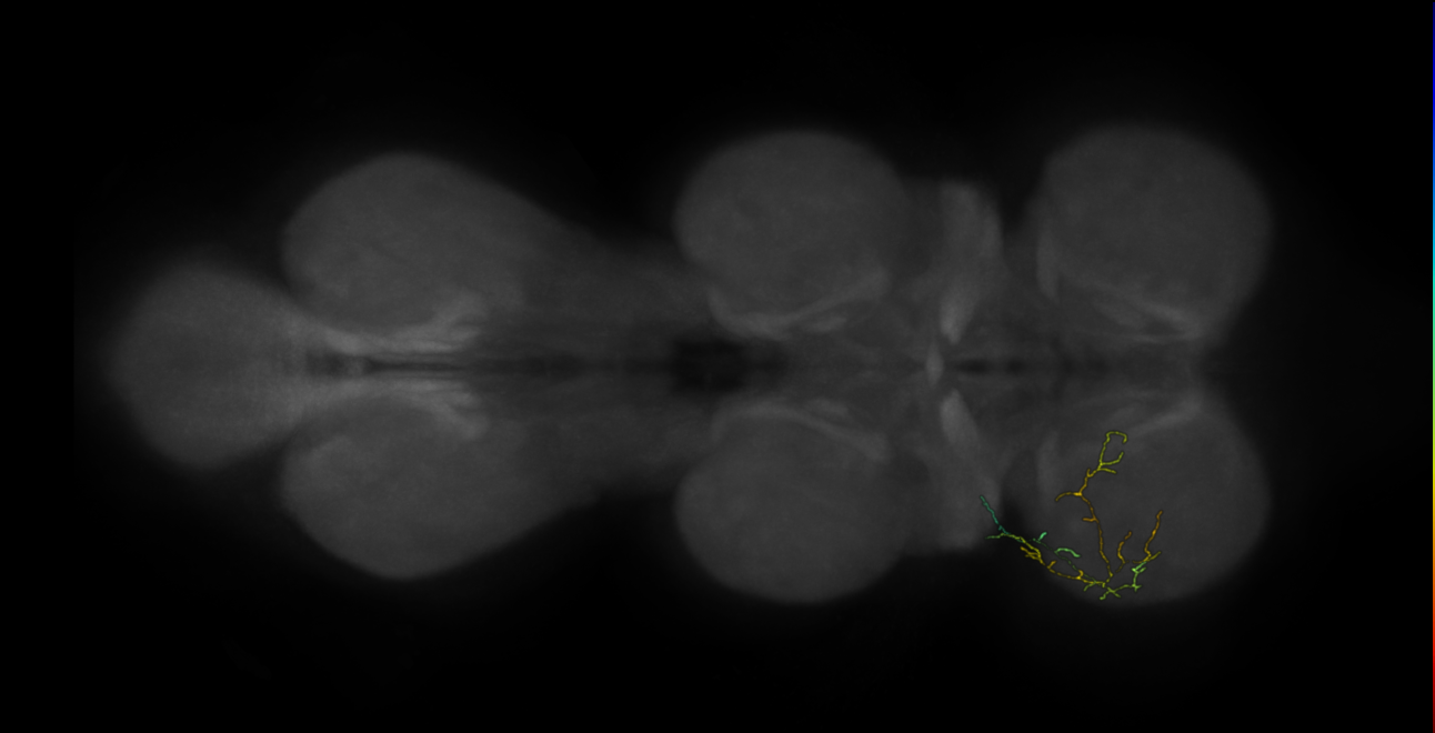 neuron 9862 - pruned by vol 109 (FANC:583707)
