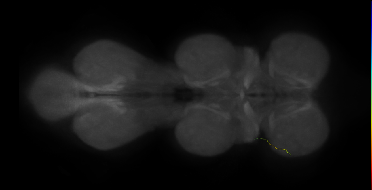 neuron 9935 - pruned by vol 109 - radius 500 (FANC:594331)
