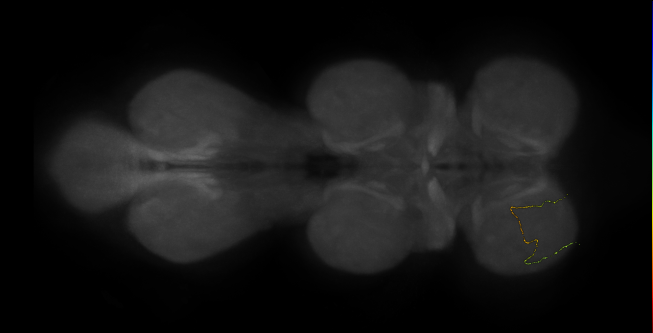 neuron 13031 - radius 500 (FANC:596711)