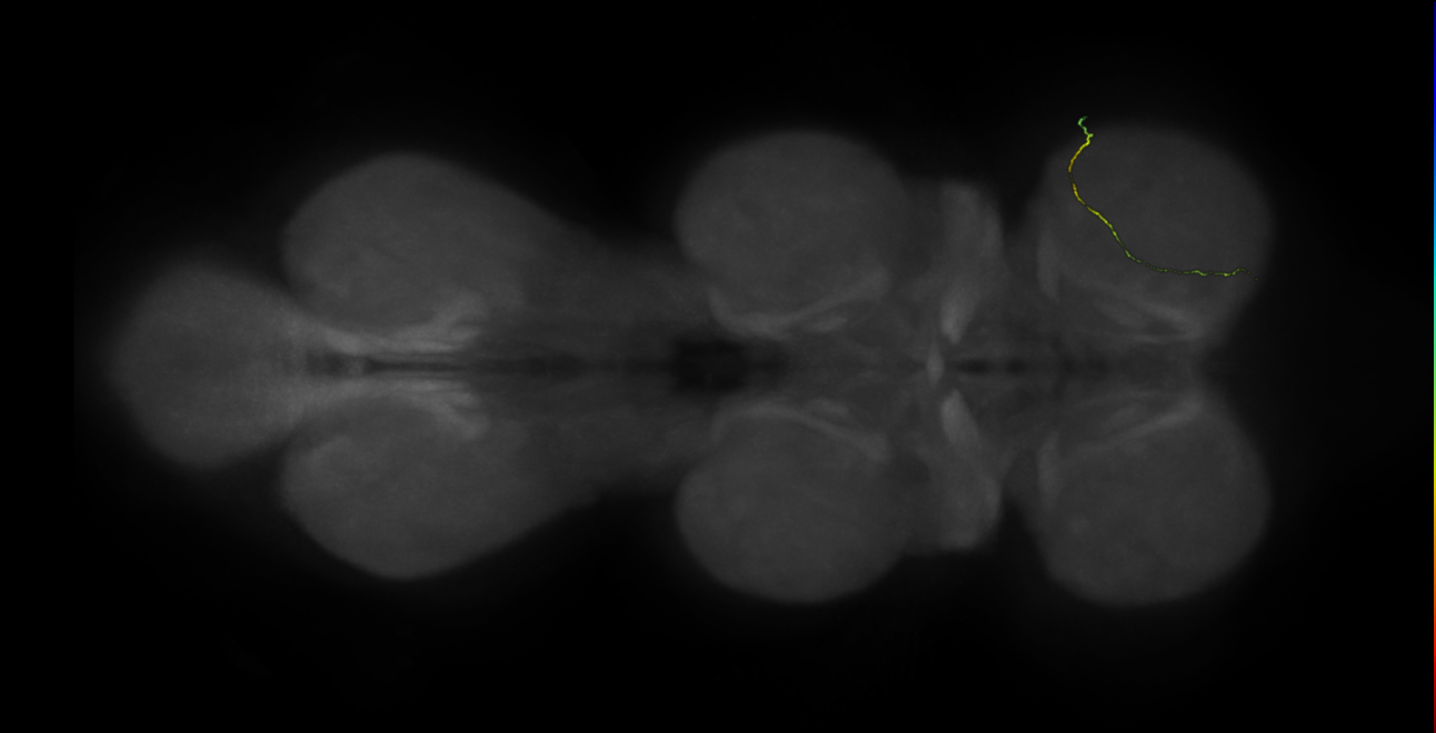 neuron 11657 - radius 500 (FANC:597138)
