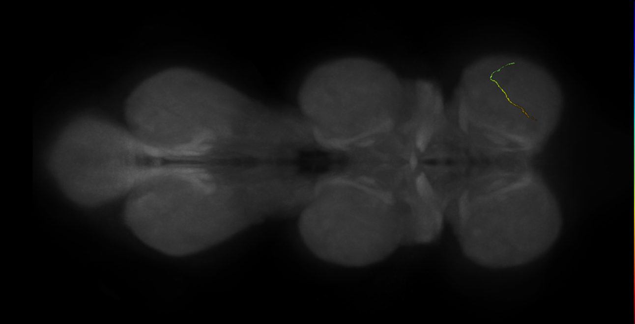 neuron 6654 - radius 500 (FANC:597797)