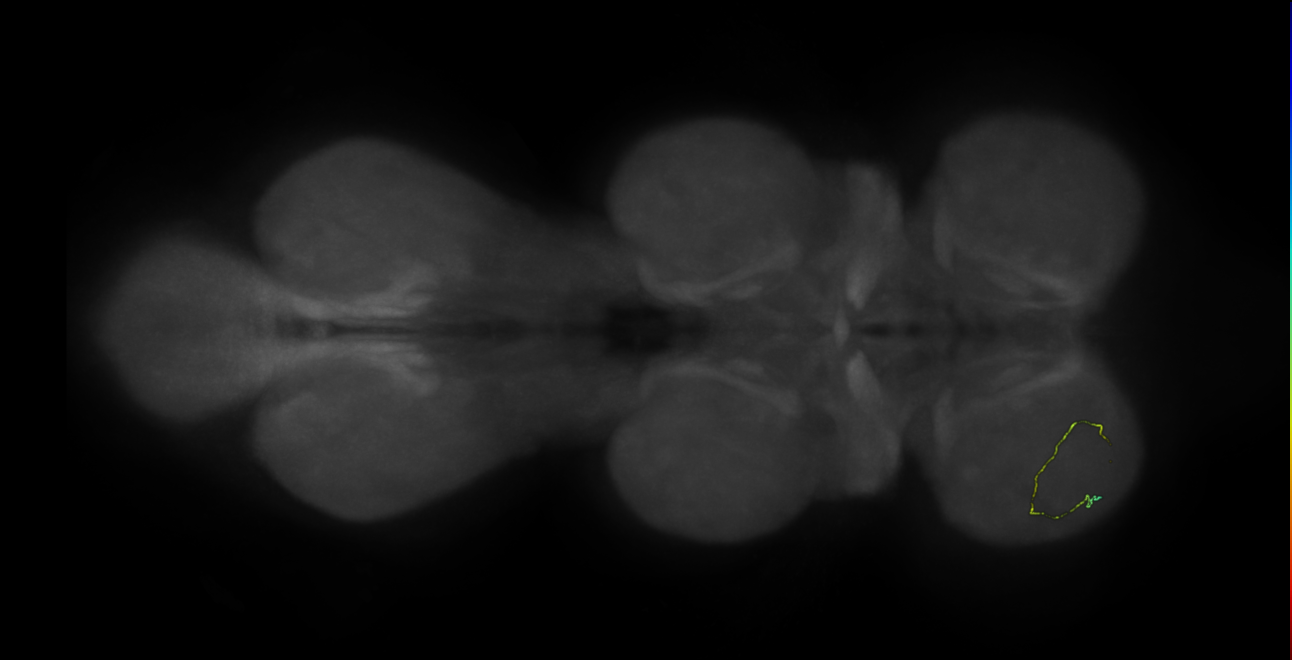 neuron 10208 - radius 500 (FANC:597933)