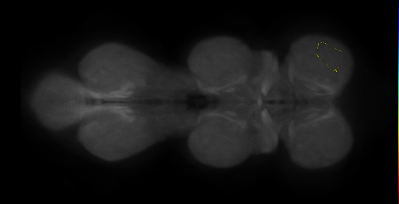 neuron 11403 - radius 500 (FANC:597974)