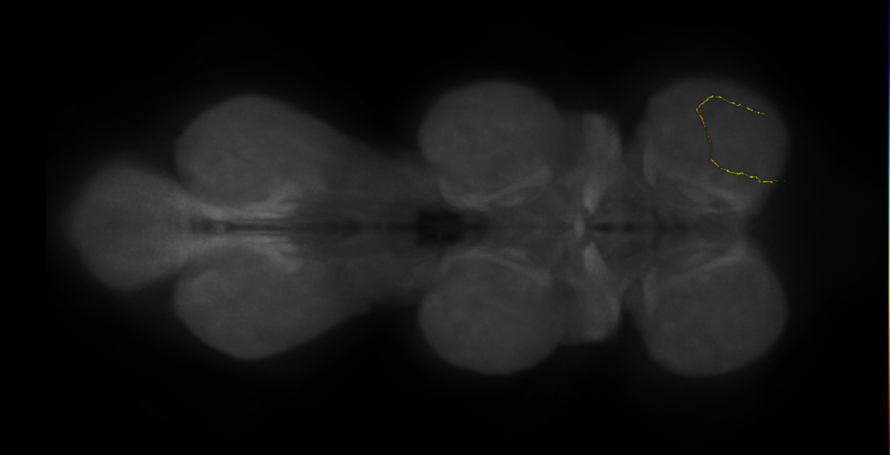 neuron 11320 - radius 500 (FANC:598209)