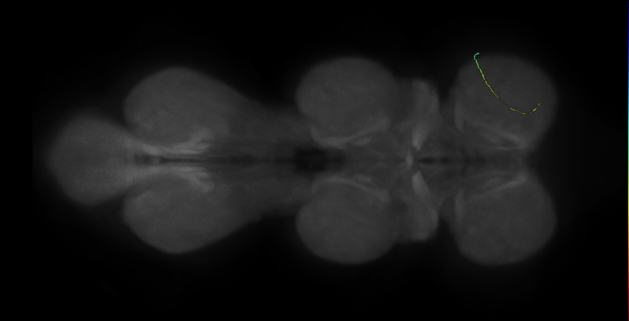 neuron 11339 - radius 500 (FANC:598519)