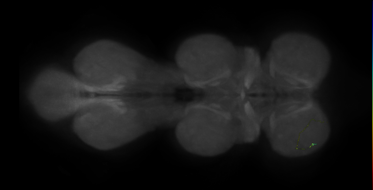 neuron 10223 - radius 500 (FANC:598559)