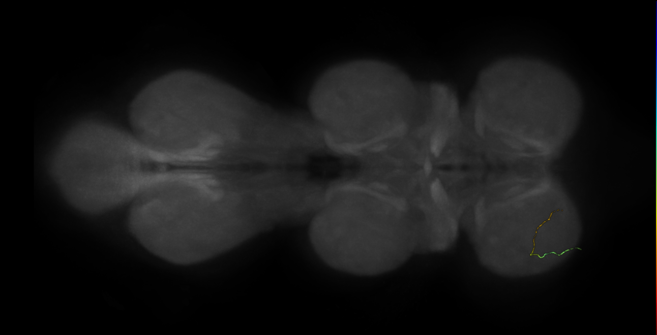 neuron 16857 - radius 500 (FANC:598773)