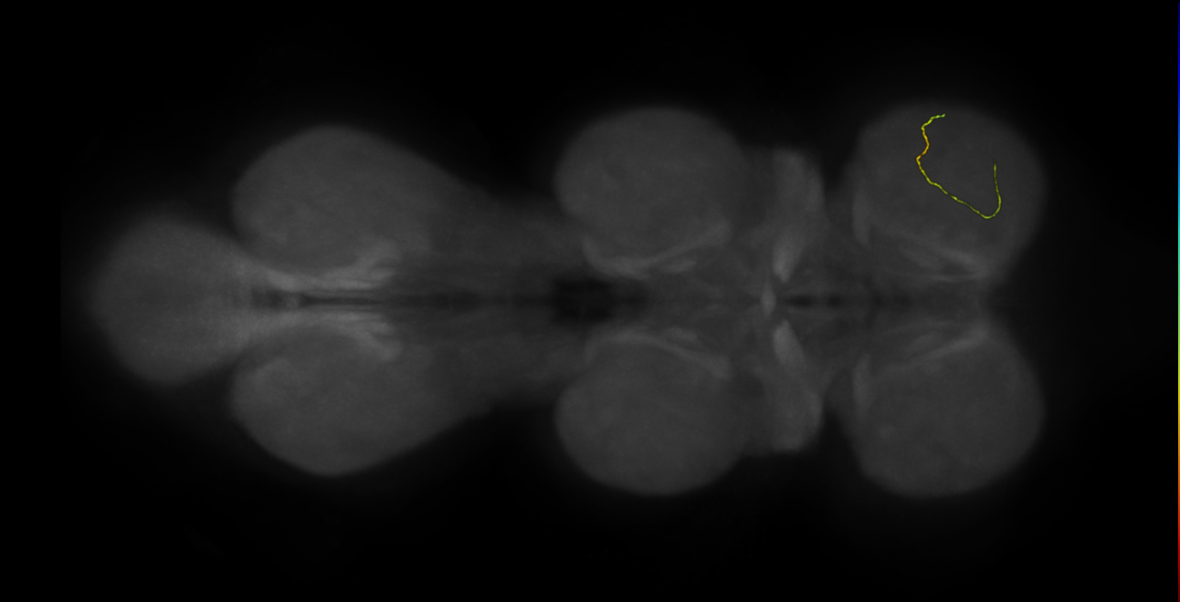 neuron 33306 - radius 500 (FANC:599017)