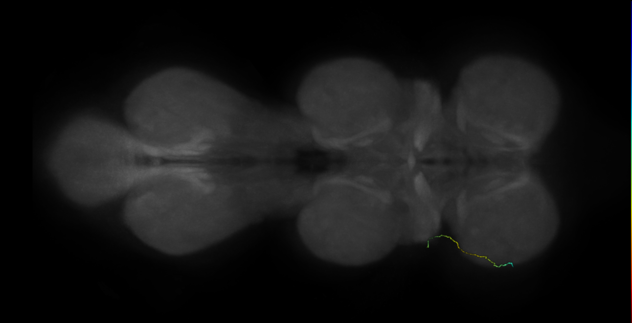 neuron 9862 - radius 500 (FANC:599231)