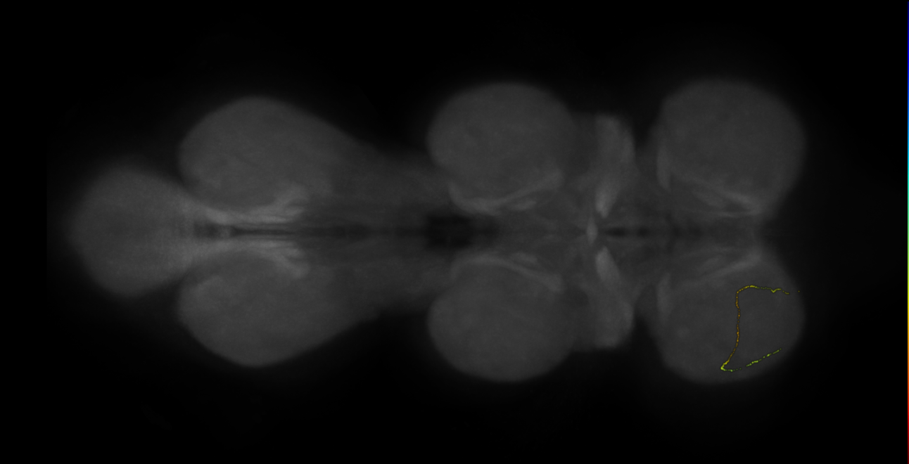neuron 2236 - flipped - radius 500 (FANC:599670)