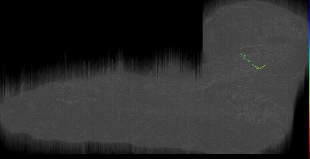 neuron 21744904 (L1EM:21744903)