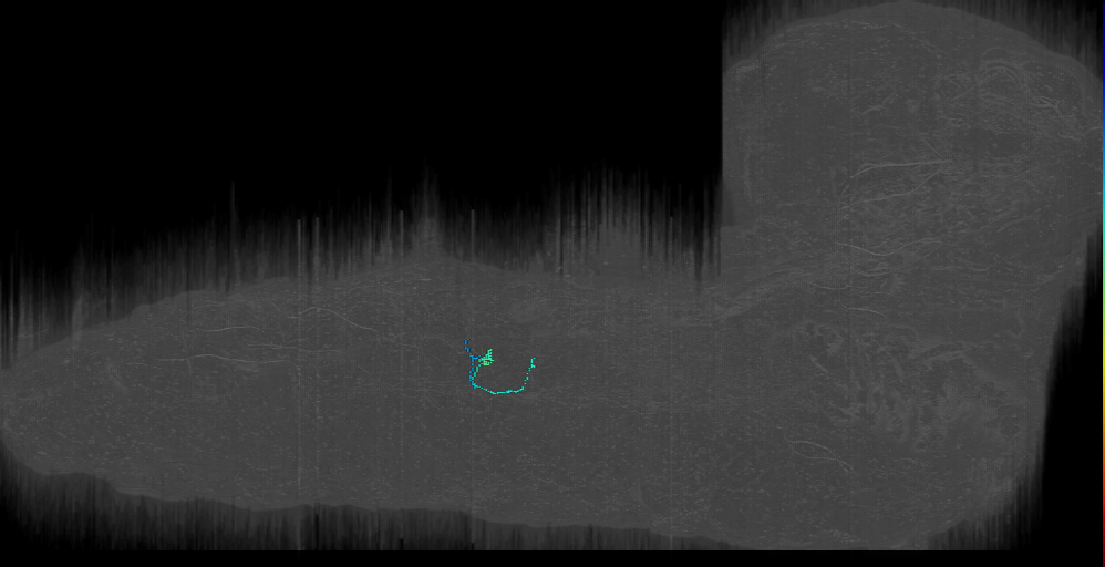 vbd_a2r (L1EM:15953777)