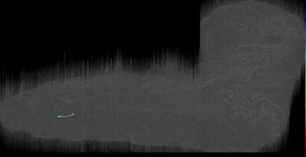 putative sensory neuron ddac? (L1EM:2292794)