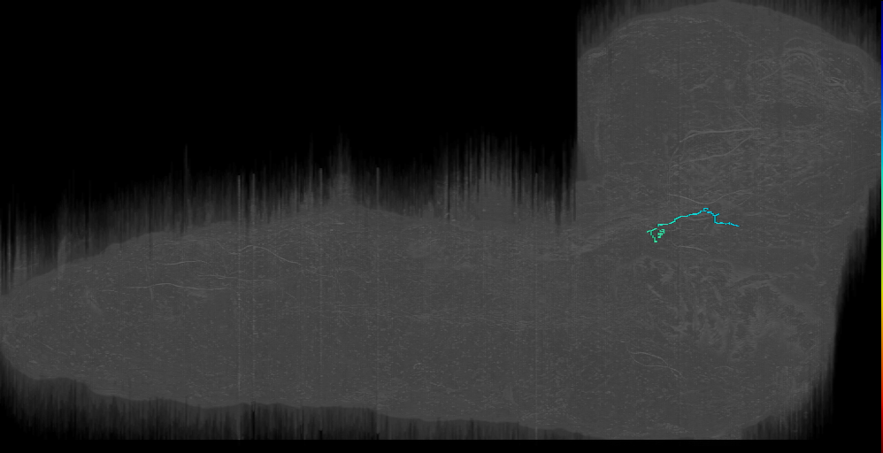 neuron 5613778 (L1EM:5613777)