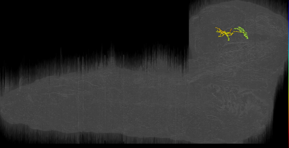 DPLam neuron left (L1EM:14162492)
