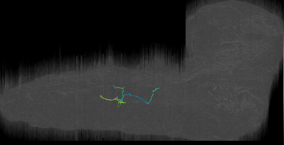 neuron 16911429 rev_A2l (L1EM:16911428)