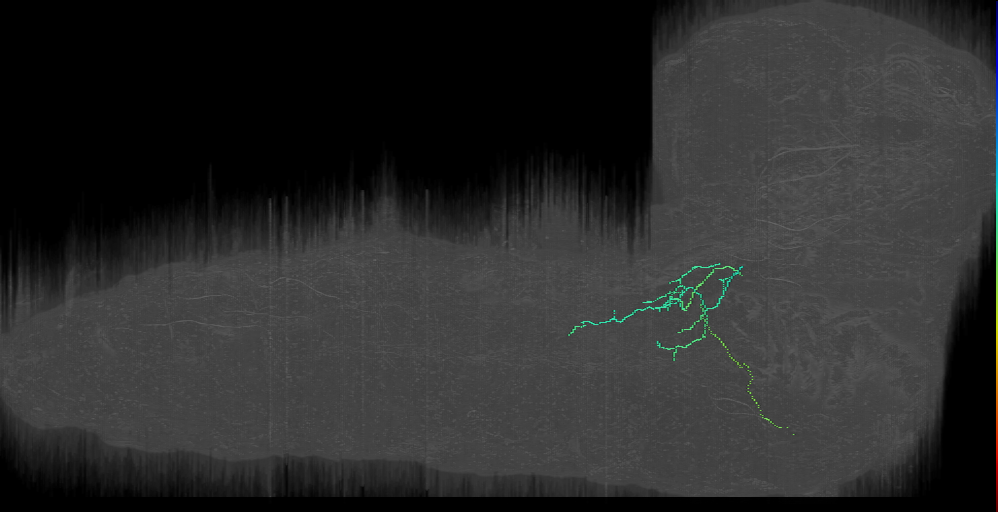SEZ pn to t3 (L1EM:18694063)
