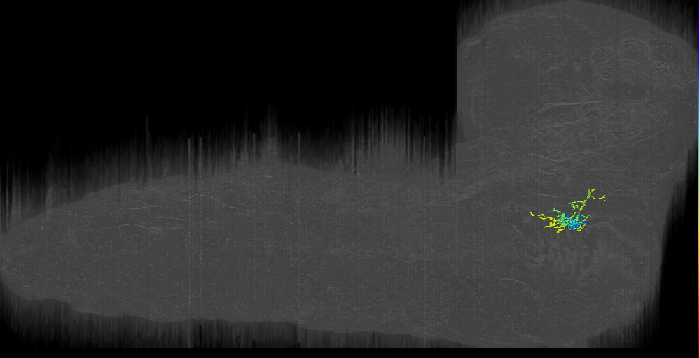 BAmas12 contra left; Interneuron--35 in total (L1EM:992646)