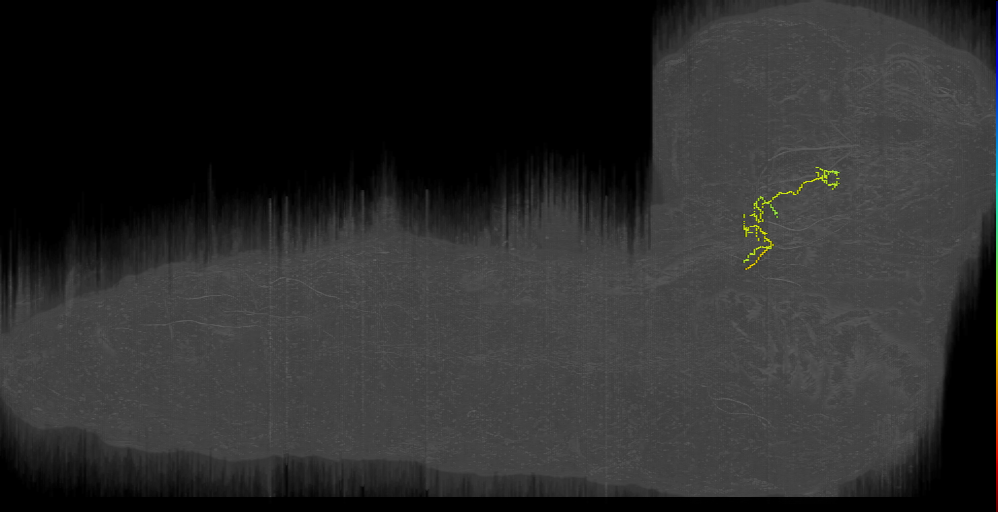 UNK brain ascending left (L1EM:1679034)
