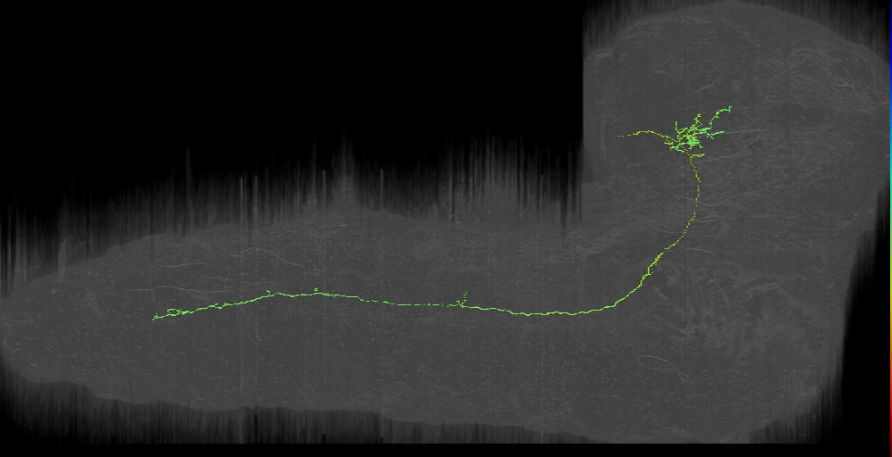 CPf descending ipsilateral-like left (L1EM:1980134)