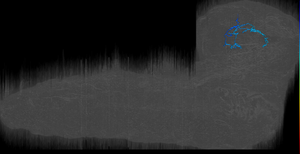 AF0: neuron right (L1EM:3010486)