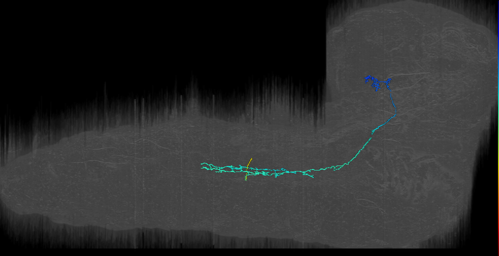 A09 Contra Brain Projection_a1l (L1EM:3220616)