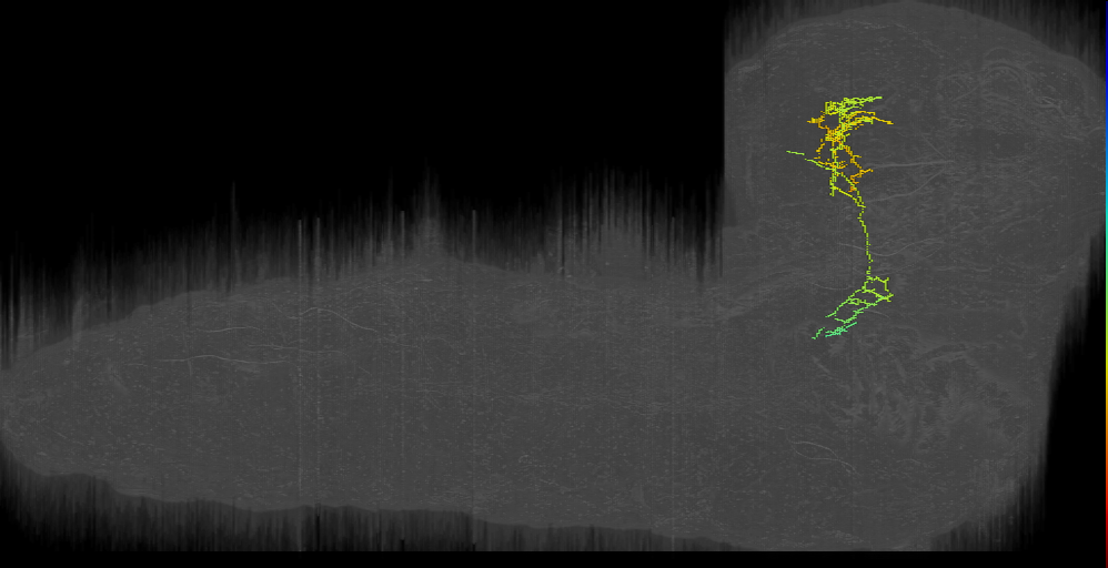 densecoreneuron_left (L1EM:3814701)