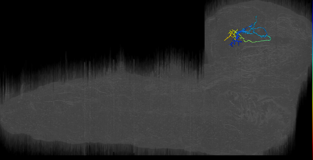 Horseshoe Bilateral right (L1EM:3913613)