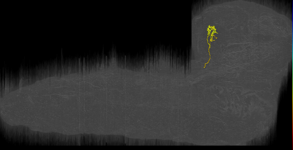 V1: possible PVL005 -  3 Left (L1EM:4570270)