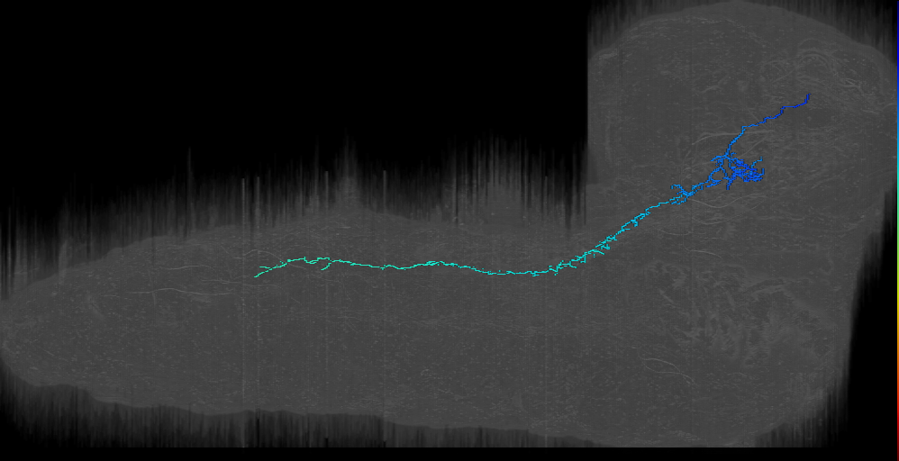 DALd descending 1 right; DALd_r 1 (L1EM:5052370)