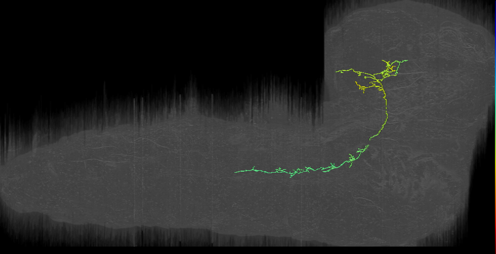 CPf descending ipsilateral left (L1EM:5690425)
