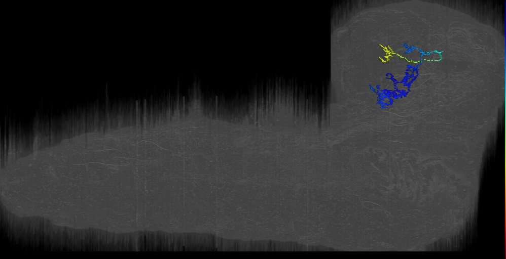 BLAv12 lat bilateral neuron 1 right (L1EM:5946241)