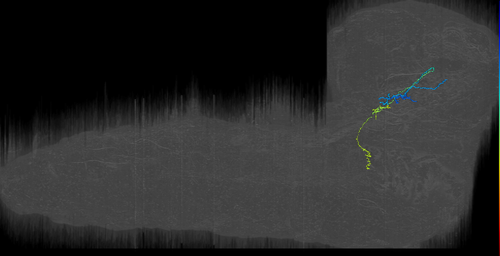 BAmd2 contralateral descending 1 right (L1EM:6702943)