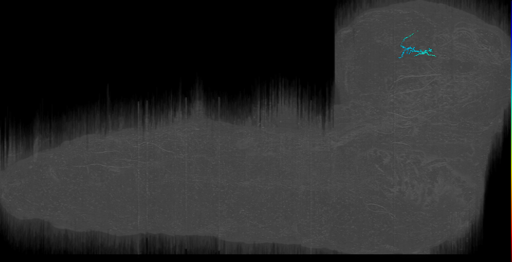 CM4-dm Tiny 2 right; CM4 dor ant 4 (L1EM:6978516)