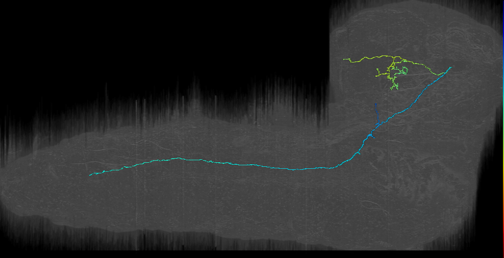 CP descending contralateral 2 left (L1EM:7005145)