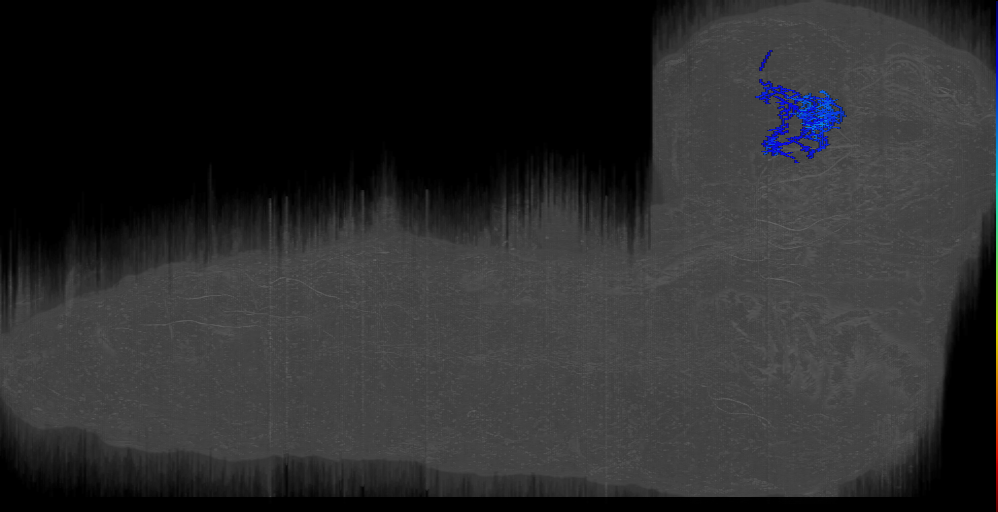 R1: upstream of telephone; LH LN? right (L1EM:7467027)