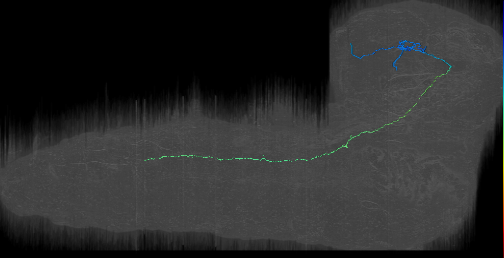 CP descending contralateral 1 right (L1EM:7589765)