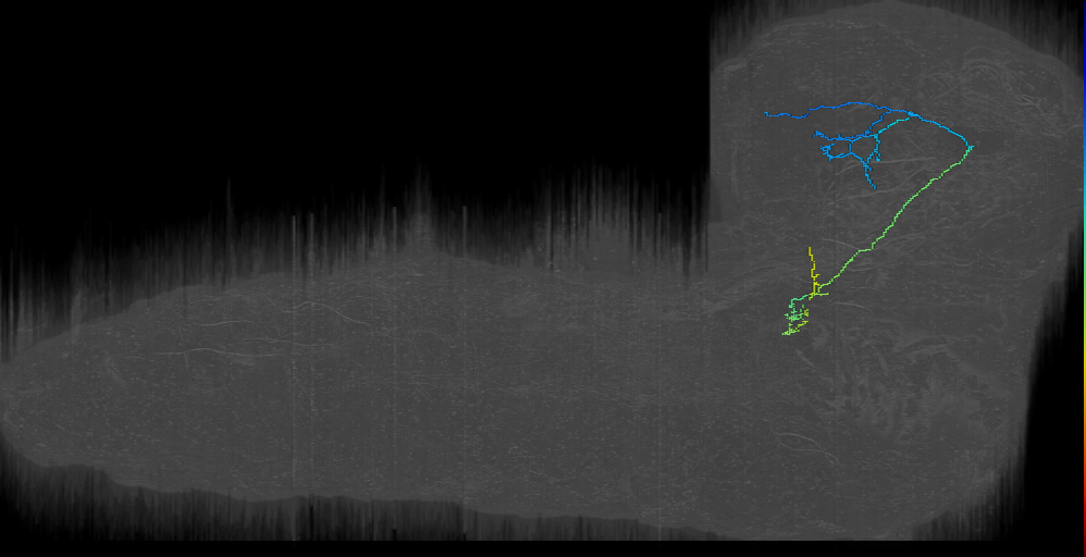 CP descending contralateral 2 right (L1EM:7590264)