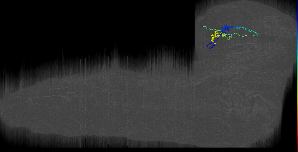 SP2-1;left (L1EM:7982896)