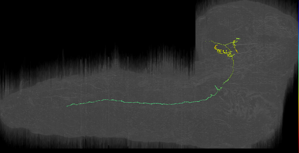 down pOLP left (L1EM:8047280)